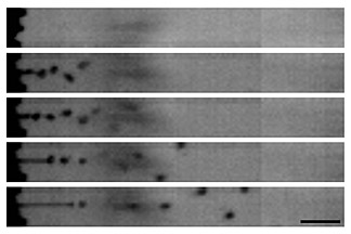 Morel Ascus Discharge